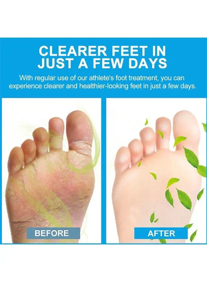 Sumifun - Foot Anti-Bacterial Cream (Original)